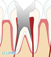 C4 イラスト